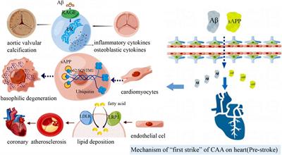 Cerebral amyloid angiopathy-related cardiac injury: Focus on cardiac cell death